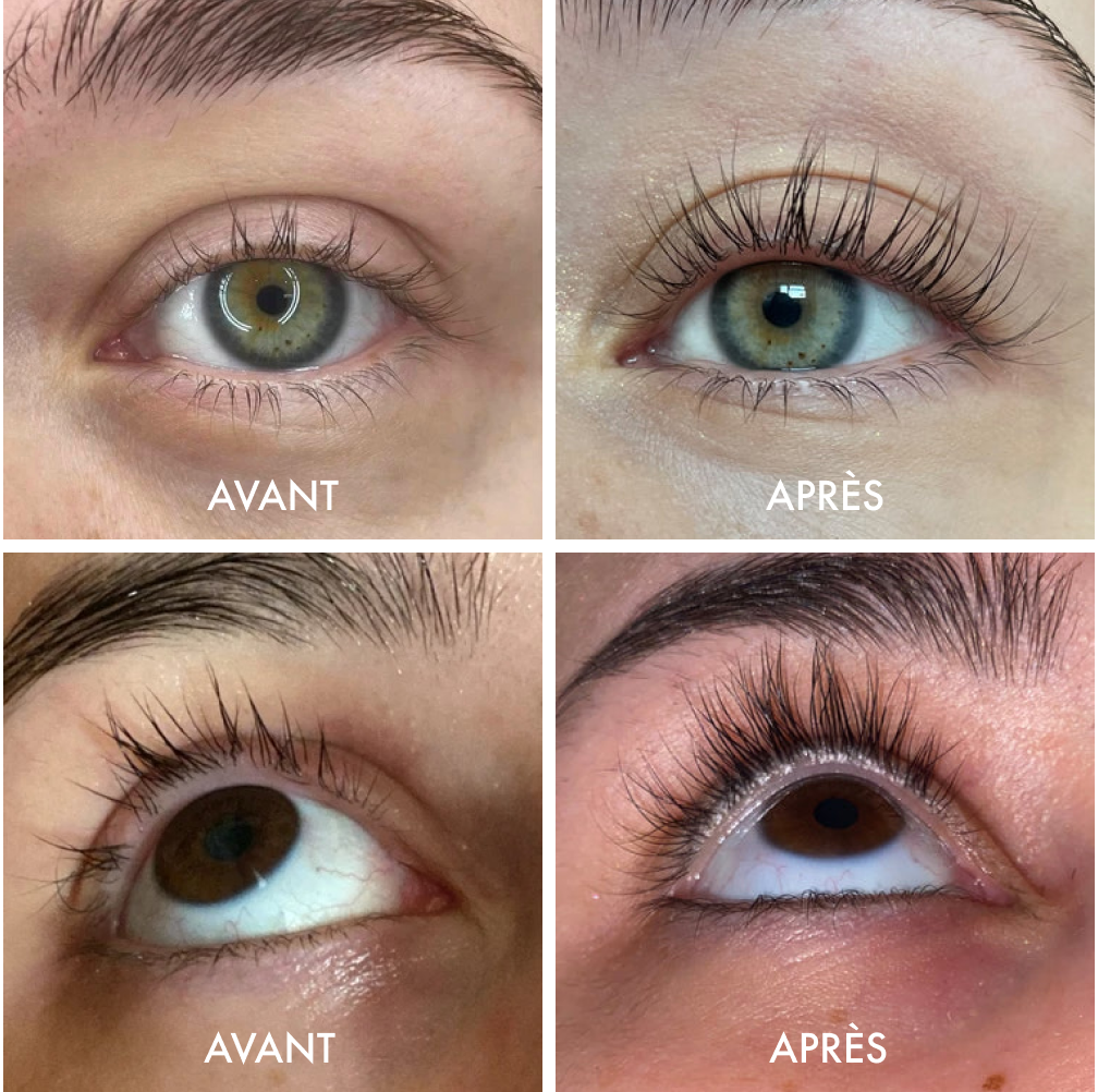 Loria™ | Natural Eyelash Growth Serum