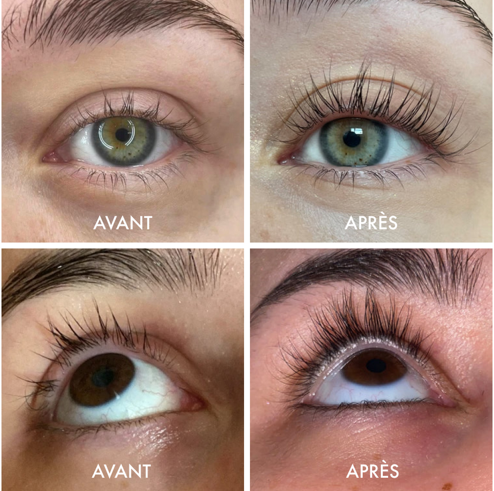 Eyelash Serum Benefits